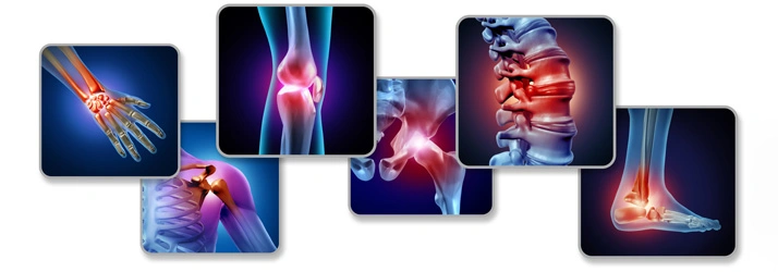 Chiropractic Burley ID Injury care Visuals of joint pain affecting the wrist, knee, spine, shoulder, hip, and ankle.