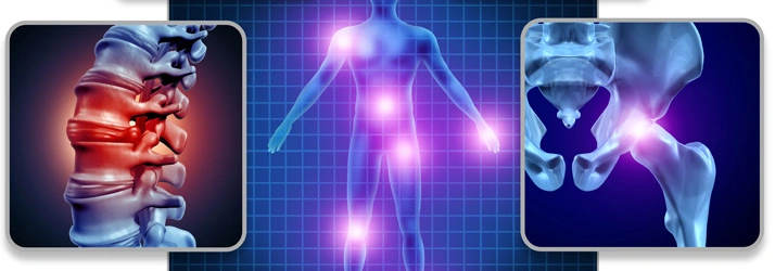 Chiropractic Burley ID services Illustrations of spinal inflammation, full-body pain points, and pelvic region discomfort.